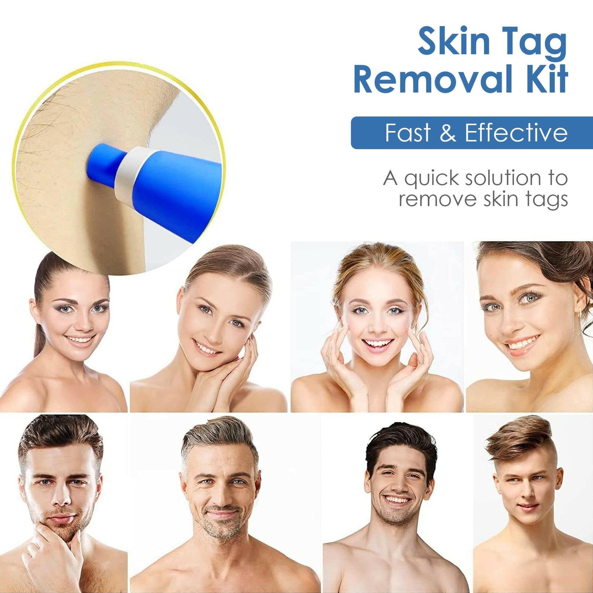  Healer Labs London - Tag Bandit Auto Skin Tag Removal Kit - The Beauty Corp.