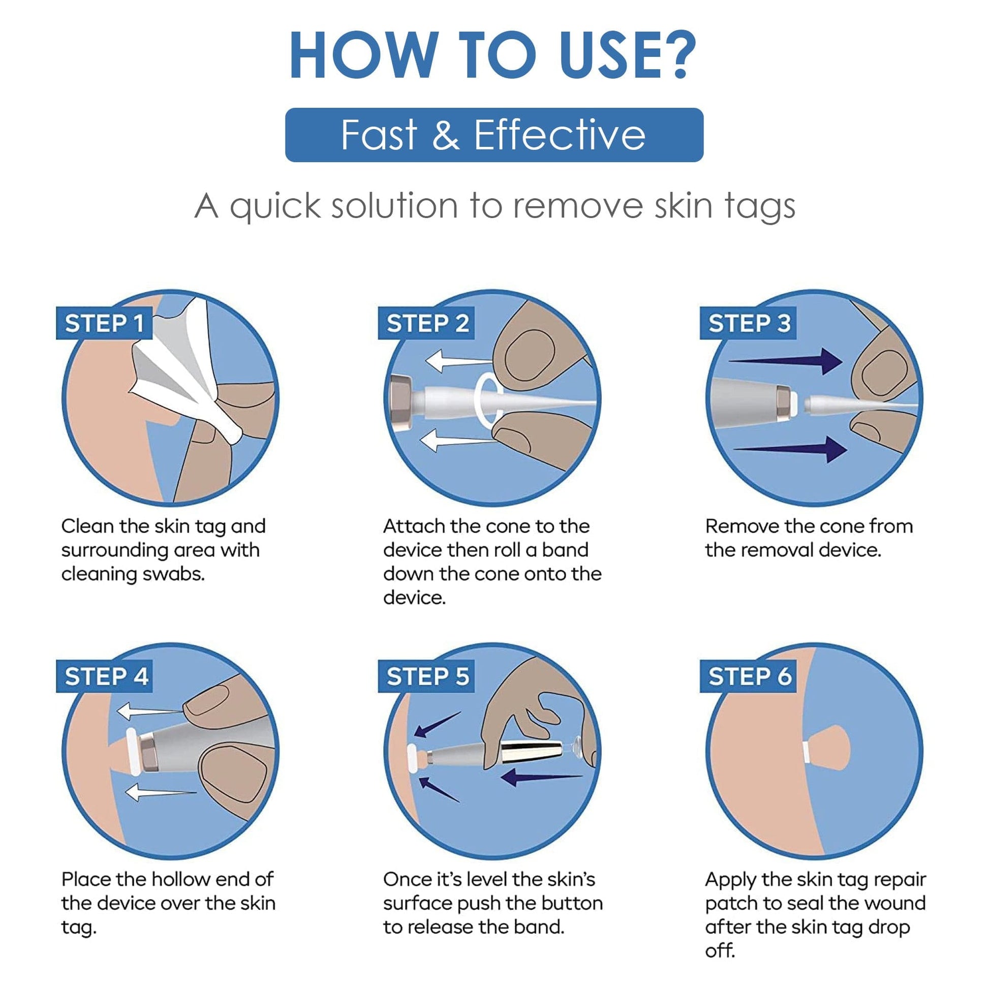  Healer Labs London - Tag Bandit Auto Skin Tag Removal Kit - The Beauty Corp.