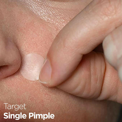 Acne Pimple Healing Hydrocolloid Patch With Salicylic Acid+Tea Tree Oil+Centella Asiatica By Healer Labs London